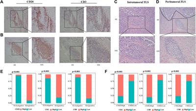 The gene signature of tertiary lymphoid structures within ovarian cancer predicts the prognosis and immunotherapy benefit